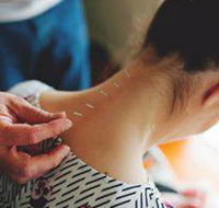 Scott Martin Acupuncture - e-Seniors