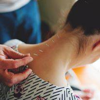 Scott Martin Acupuncture - e-Seniors 0
