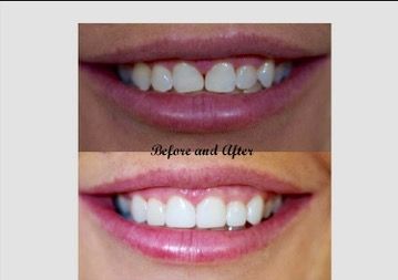 A+ Family Dental - e-Seniors 4