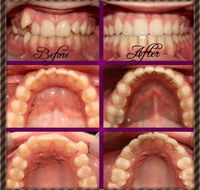 Coral Coast Dental - e-Seniors