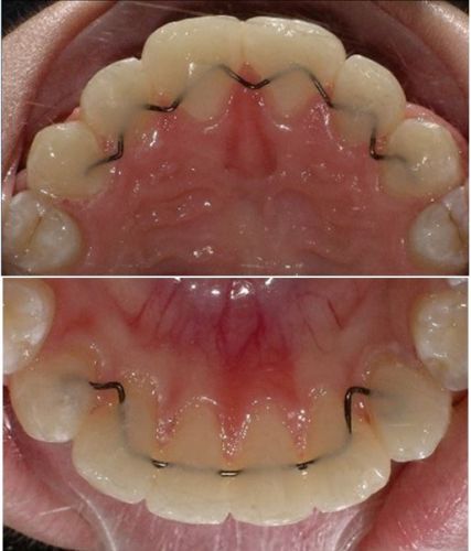 Cave Steven Dr – Specialist Orthodontist - e-Seniors 3