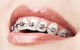Dental Centre Maleny - thumb 4