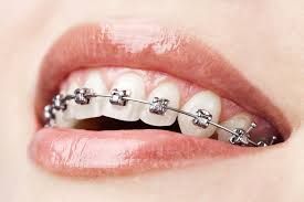 Dental Centre Maleny - e-Seniors 4