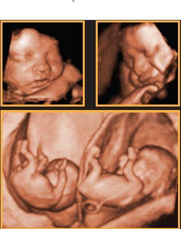 Sarina Medical Imaging - e-Seniors 0